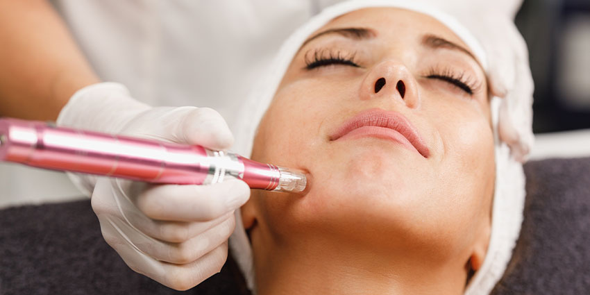 patient needing microneedling in San Jose, CA