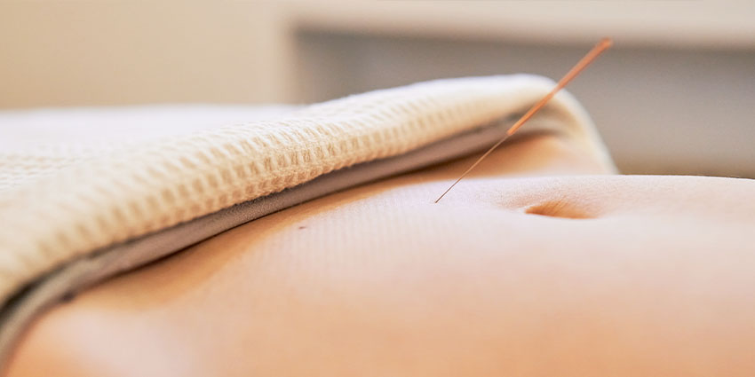 patient needing Infertility acupuncture in San Jose, CA