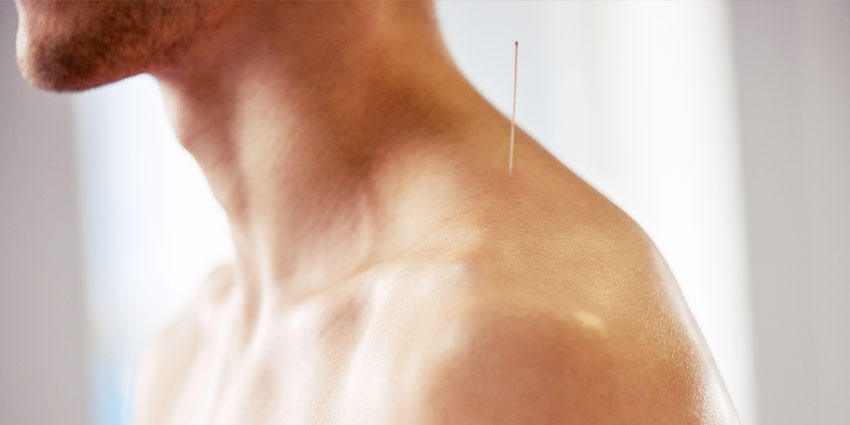 patient needing Mental Health acupuncture in San Jose, CA