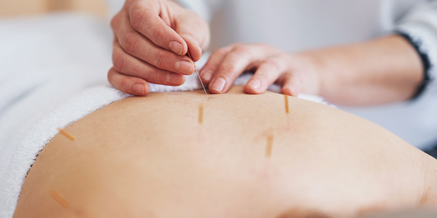 patient needing Pain relief acupuncture in San Jose, CA