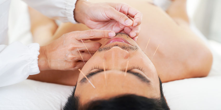 patient needing Stress relief acupuncture in San Jose, CA