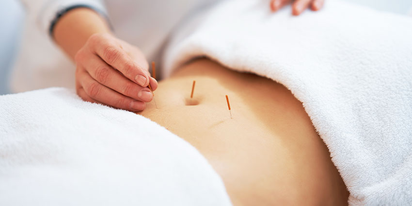 patient needing Women's Health acupuncture in San Jose, CA