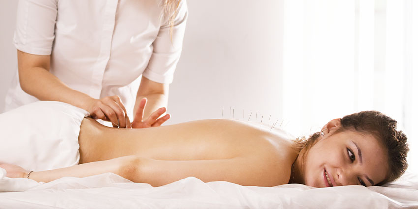 patient getting acupuncture San Jose, CA