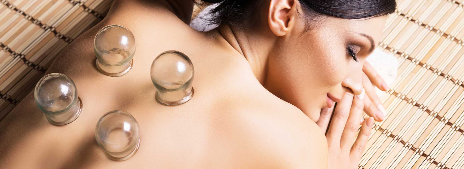 patient getting cupping therapy in San Jose, CA