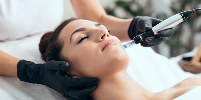 microneedling in San Jose, CA